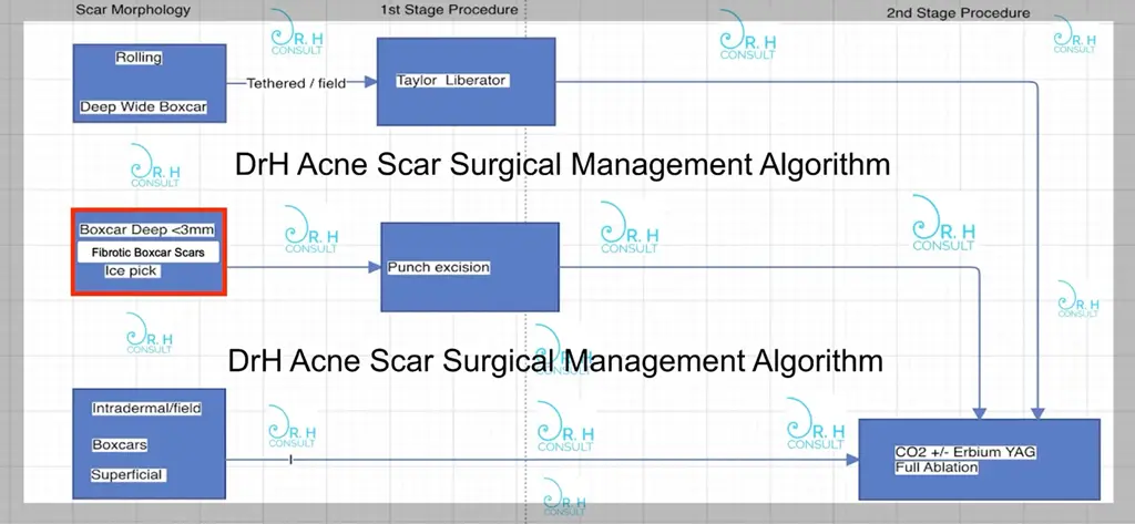 dr h acne scar algorithm boxcar scars