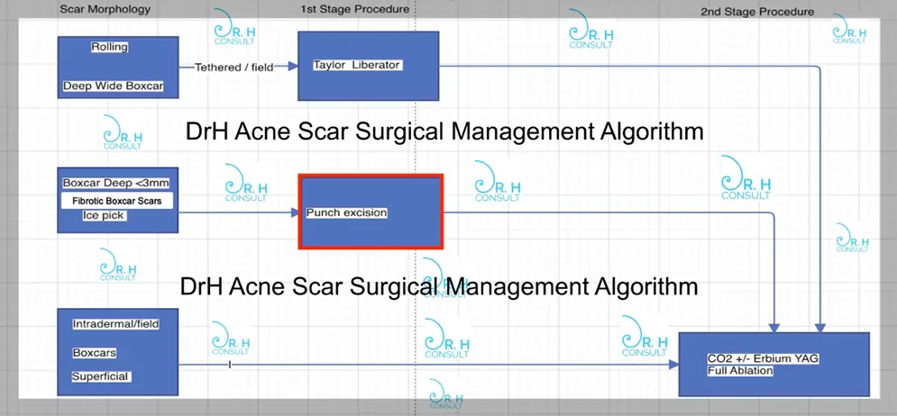 dr h acne scar algorith punch excision